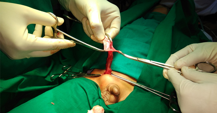 surgery_12 surgery_12